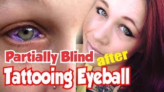 5 Things About Catt Gallinger Partially Blind After Tattooing of the Eyeball [upl. by Ratcliff]