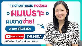 ผมเปราะ  ผมขาดง่าย Trichorrhexis nodosa [upl. by Bibbye21]