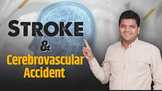 Stroke amp Cerebrovascular Accident CVA  MedicalSurgical  Nervous System by DrPriyanshJain [upl. by Dranoel]