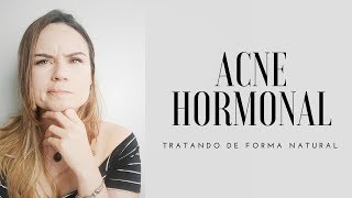 ACNE HORMONAL  COMO TRATAR DE FORMA NATURAL [upl. by Ardekahs686]