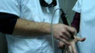 Video Endolaser 476 Hospital del Trabajador [upl. by Lundt629]