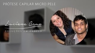 Protese Capilar Masculina Micro Pele – Luciana Cruz [upl. by Bez497]