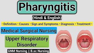 Pharyngitis Definition Causes Signs and symptoms Diagnosis Treatment  Pharyngitis In Hindi [upl. by Naimerej]