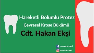 Hareketli Bölümlü Protez Çevresel Kroşe Bükümü bölümlüprotez protez [upl. by Ruon714]