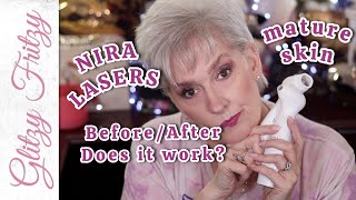 NIRA LasersLies 90 days 61 Year Mature Skin notsponsored [upl. by Scholz]