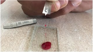 Blood Clotting Time Determination by Slide Method  Blood Clotting Time  Find Blood Clotting Time [upl. by Saree]