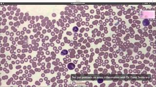 What blood looks like down the microscope [upl. by Bywaters646]