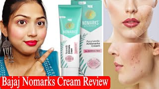 Bajaj Nomarks Cream Review  Remove Acne Scars Dark Spots Blemish  For Normal Skin [upl. by Strade]