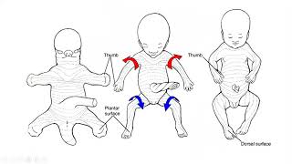 DEVELOPMENT OF LIMBS [upl. by Anuska]