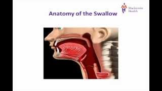 Stroke Education  Dysphagia [upl. by Eerac]