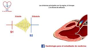 Auscultación de la estenosis valvular aórtica [upl. by Feodor]