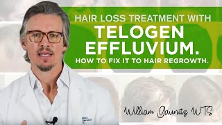 Telogen Effluvium Hair Loss  What is it How To Fix It Fast [upl. by Bigelow]