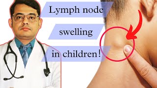 Lymph node swelling in childrenLymphadenopathyCause symptoms treatment [upl. by Yleik]