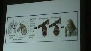 ACUTE SEVERE ASTHMA [upl. by Neiv176]