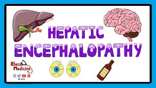 Hepatic Encephalopathy  Pathophysiology Stages and West Haven Criteria [upl. by Nnylarac]