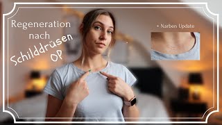 Update nach Schilddrüsen OP ⎢Regeneration ⎢OP Narbe ⎢Tipps nach der OP ⎢Erfahrungsbericht 🏥 [upl. by William]