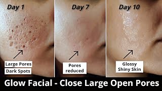 How To Get Rid Of LARGE PORES PERMANENTLY 100 Works Shrink amp Get Clear Glass Skin Naturally [upl. by Aika]