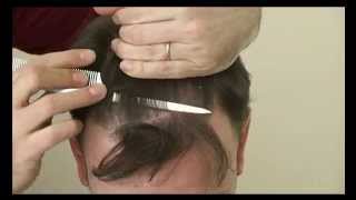 5889 FUT Hattingen Hair Transplantation Switzerland [upl. by Llerdnek]