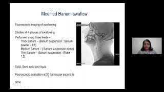 Reducing Dysphagia and Aspiration in Head Neck CancersProf Ashwini Budrukkar TMH Mumbai [upl. by Ku]