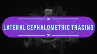 Lateral Cephalometric Tracing [upl. by Oiled]