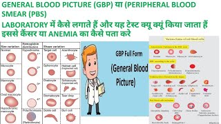 CBC SE GBP या PBS GENERAL BLOOD PICTURE or PERIPHERAL BLOOD SMEAR KI REPORT KAISE BANAYE [upl. by Mazman]