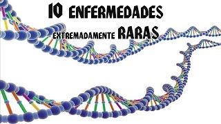 10 ENFERMEDADES EXTREMADAMENTE RARAS [upl. by Alden]