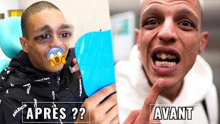 SAMOS a REFAIT ses DENTS 😱🦷 clinique samos [upl. by Etteuqaj519]