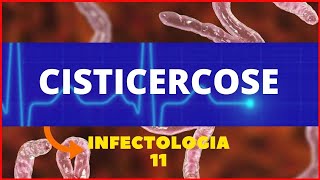 CISTICERCOSE  TAENIA SOLIUM  PARASITOLOGIA  INFECTOLOGIA [upl. by Aissak]