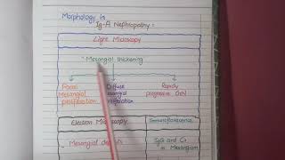 IgA Nephropathy  Pathology [upl. by Nrubliw]