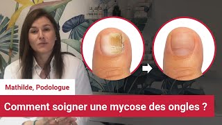 Soigner et reconnaitre la mycose des ongles des pieds  Conseil dune podologue [upl. by Fredericka710]