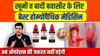 खूनी हो या बादी बवासीर को ठीक करने की सबसे अच्छी होम्योपैथिक दवा Homoeopathic medicine for piles। [upl. by Arvid]