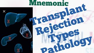 Pathology of all Transplant Rejection Types Mnemonic [upl. by Wit354]