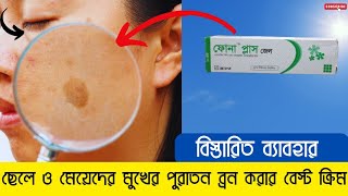 fona plus gel এর উপকারিতা  ফোনা প্লাস জেল ব্যাবহার করার নিয়ম  মুখের ব্রন দুর করার বেস্ট ক্রিম [upl. by Ellennoj885]