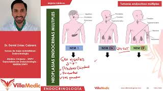 Tumores endocrinos múltiples  Endocrinologia [upl. by Anayt]