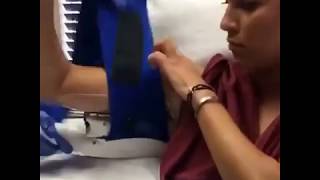 Coolsculpting NonSurgical Fat Reduction of the Upper Arm [upl. by Notna374]