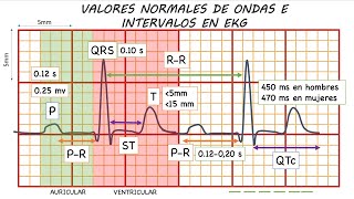 ELECTROCARDIOGRAMA NORMAL GUÍA DEFINITIVA [upl. by Alburg]