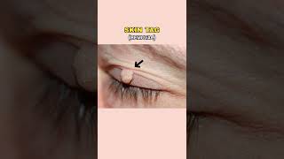 Eye Problem What Can Treat Or What Can’t  Dr Sarin [upl. by Ermin]