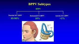 BPPV  Preliminary Insights [upl. by Reace]