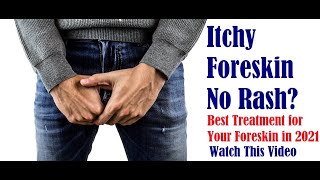 Itchy Foreskin No Rash Best Treatment in 2021 for Balanitis Phimosis amp Fungal Infection [upl. by Nonnerb]