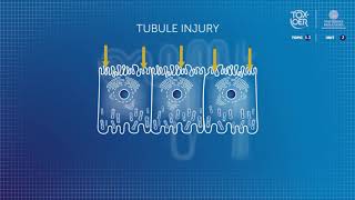 TOXOER 53 Kidney 2 2 Mechanisms of Nephrotoxicity II [upl. by Aillicsirp]