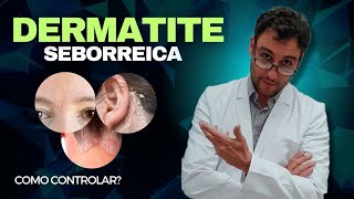 Como controlar a Dermatite Seborreica [upl. by Mccartan]