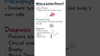 ORAL LICHEN PLANUS EXPLAINED [upl. by Remat]