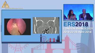 ERS London 2018 Revision Sinus Surgery Panel Discussion [upl. by Stodder161]