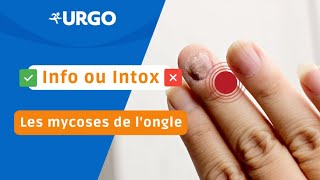 Info ou Intox  Les mycoses de l’ongle  URGO [upl. by Sudnac]