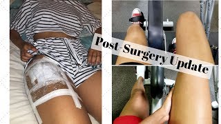 My Hip Labral Tear Ep 5  1 Week Post Surgery [upl. by Ahsilaf]