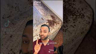 How To Get Rid Of Bed Bugs  Fast Dr Somji Explains [upl. by Mikeb]