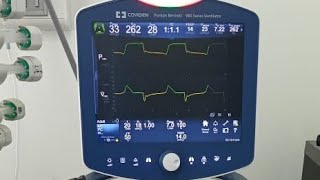 Settingan ventilator Part 5 part akhir Weaning ventilator [upl. by Arnie]