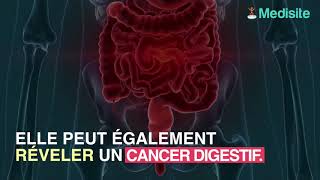 Une grosseur sur le nombril sest révélée être un cancer des ovaires [upl. by Sualokcin440]