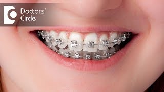 How long will it take to close the gaps with invisible braces  Dr Shobith R Shetty [upl. by Brok585]