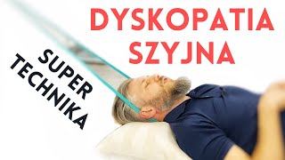 DYSKOPATIA SZYJNA rwa barkowa  super technika zmniejszająca ucisk  dr n med Marcin Wytrążek [upl. by Ariajaj]